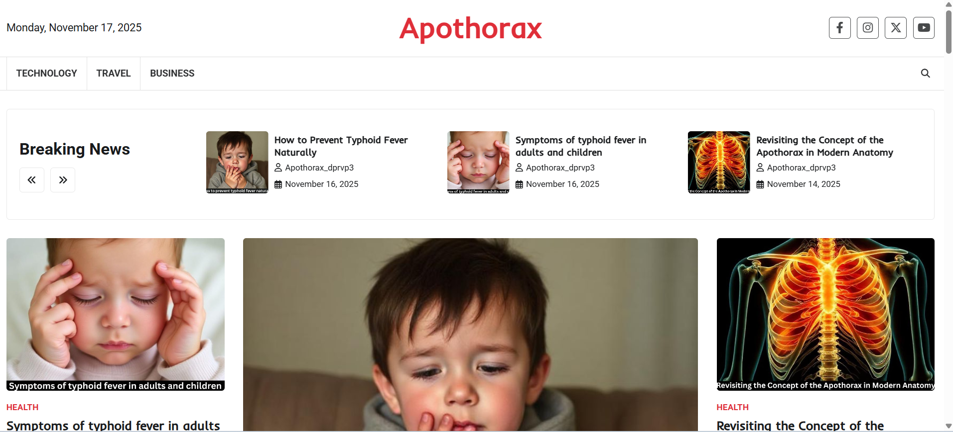 Key Differences Between Apothorax, Mesothorax, and Metathorax
